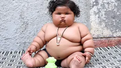 World's Fattest Baby